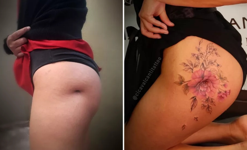 Tatuadora usa desenhos para cobrir cicatrizes de mulheres: 'Resgate da autoestima'
